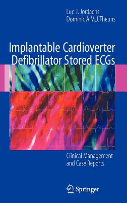 Image for Implantable Cardioverter Defibrillator Stored ECGs: Clinical Management and Case Reports