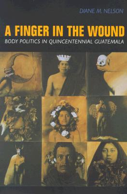 A Finger in the Wound: Body Politics in Quincentennial Guatemala