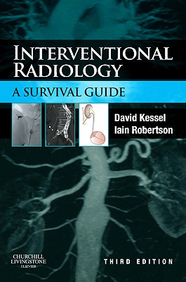 Interventional Radiology: A Survival Guide