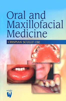 Oral and Maxillofacial Medicine: The Basis of Diagnosis and Treatment