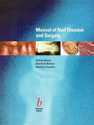 Manual of Nail Disease and Surgery