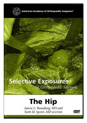 Selective Exposures in Orthopaedic Surgery: The Hip
