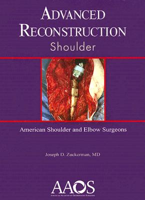 Advanced Reconstruction Shoulder (American Academy of Orthopaedic Surgeons)