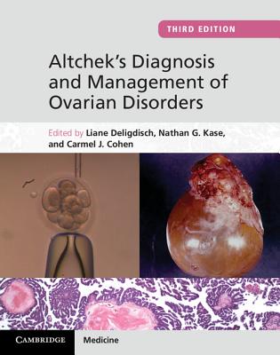 Altchek's Diagnosis and Management of Ovarian Disorders [Hardcover] Deligdisch, Liane; Kase, Nathan G. and Cohen, Carmel J.