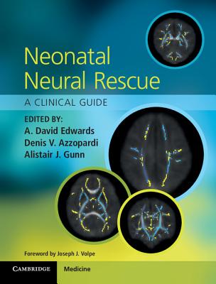 Image for Neonatal Neural Rescue: A Clinical Guide Neonatal Neural Rescue: A Clinical Guide