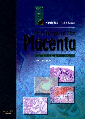 Pathology of the Placenta, 3e (Major Problems in Pathology) [Hardcover] [Jul 09, 2007] Fox MD FRCPath FRCOG, Harold and Sebire MB BS FRCPath, Neil
