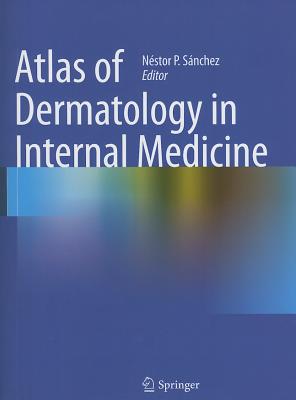 Atlas of Dermatology in Internal Medicine