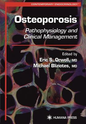 Osteoporosis: Pathophysiology and Clinical Management (Contemporary Endocrinology)