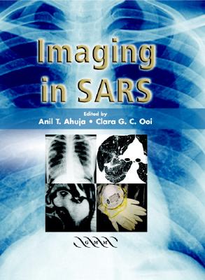Imaging in SARS [Hardcover] by Ahuja, A. T.; Ooi, C. G. C.