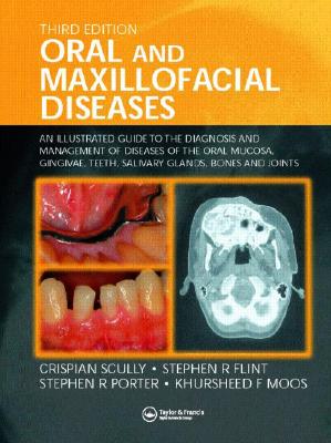 Oral And Maxillofacial Diseases: An Illustrated Guide To Diagnosis And Management Of Diseases Of The Oral Mucosa, gingivae, teeth, salivary Glands, bones and Joints