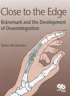 Close To The Edge: Branemark And The Development Of Osseointegration